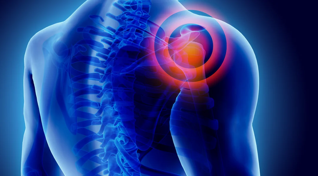 How Long Do Steroid Joint Injections Last?
